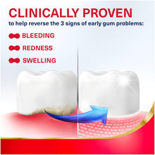 Parodontax Active Gum Repair Toothpaste, Toothpaste To Help Reverse Signs Of Ear — Complimentary Gift with $24+ Orders; If the Gift Is Out of Stock or Its Price Rises, Order Cancelled with Full Refund Before Shipment